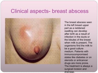 Clinical aspects- breast abscess
The breast abscess seen
in the left breast upper
part as a reddened
swelling can develop
after birth as a result of
infection in the ducts or
the lobules of the breast
when milk is present. The
organisms find the milk to
be a good culture
medium. Patients with
immunocompromised
states like diabetes or on
steroids or anticancer
drugs are more prone.
The treatment is always a
surgical incision and
drainage.
 