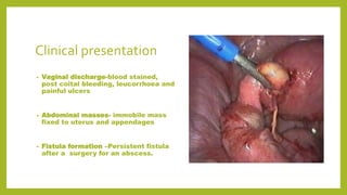 Clinical presentation
• Vaginal discharge-blood stained,
post coital bleeding, leucorrhoea and
painful ulcers
• Abdominal masses- immobile mass
fixed to uterus and appendages
• Fistula formation –Persistent fistula
after a surgery for an abscess.
 