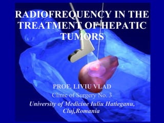 RADIOFREQUENCY IN THE TREATMENT OF HEPATIC TUMORS PROF. LIVIU VLAD Clinic of Surgery No. 3 University of Medicine Iuliu Hatieganu, Cluj,Romania  