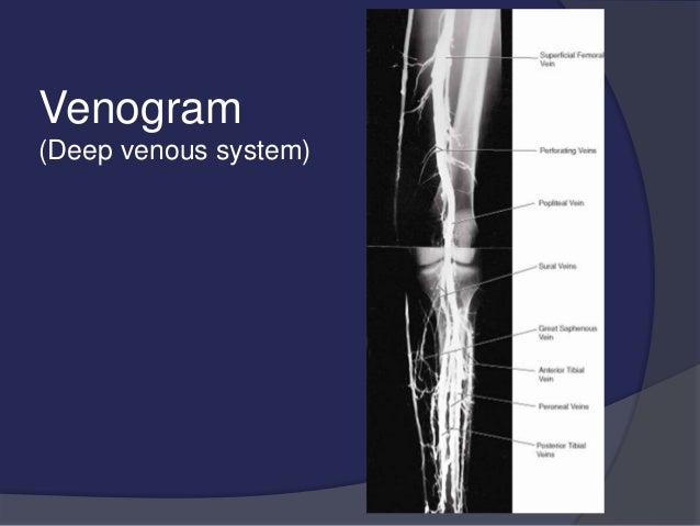 venous drainage of the lower limb
