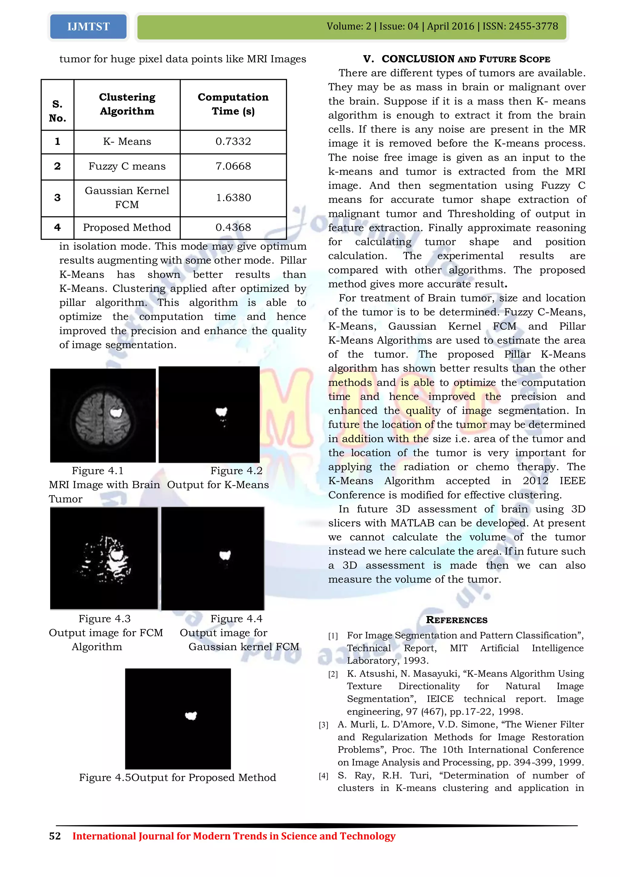 Comparison of Image Segmentation Algorithms for Brain Tumor Detection | PDF