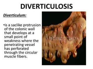 DIVERTICULOSIS
Diverticulum:
•is a saclike protrusion
of the colonic wall
that develops at a
small point of
weakness where the
penetrating vessel
has perforated
through the circular
muscle fibers.
 