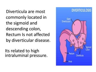 Diverticula are most
commonly located in
the sigmoid and
descending colon,
Rectum Is not affected
by diverticular disease.
Its related to high
intraluminal pressure.
 