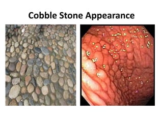 Cobble Stone Appearance
 