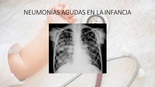 NEUMONÍAS AGUDAS EN LAINFANCIA
 