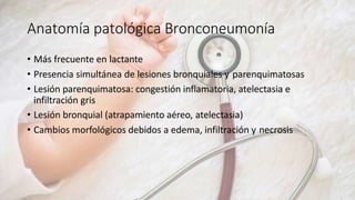 Anatomía patológica Bronconeumonía
• Más frecuente en lactante
• Presencia simultánea de lesiones bronquiales y parenquimatosas
• Lesión parenquimatosa: congestión inflamatoria, atelectasia e
infiltración gris
• Lesión bronquial (atrapamiento aéreo, atelectasia)
• Cambios morfológicos debidos a edema, infiltración y necrosis
 