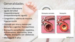 Generalidades
• Proceso inflamatorio
agudo del árbol
traqueobronquial
(traqueobronquitis aguda)
• Congestion y edema de mucosa,
hipersecreción
• Causado por virus y, menos por
bacterias o agentes fisicoquímicos
• Bronquitis asmatiforme, espástica,
enfisematosa, obstructiva, tórax
silbante, bronquitis con sibilancias
• Menores de 4 años
 