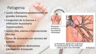 Patogenia
• Lesión inflamatoria predominante en
grandes bronquios
• Congestión de la mucosa e
infiltración leucocitaria
(mononuclear),
• Lesión ciliar, edema e hipersecreción
mucosa
• Zonas de ulceración con necrosis del
epitelio
• Extensas lesiones destructivas
(obstrucción bronquial)
 