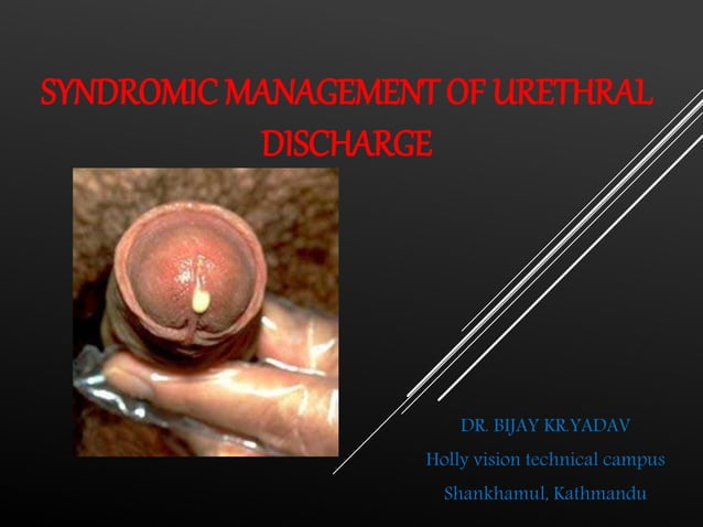 21. Syndromic management of urethral discharge | PPT