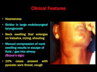 21. evaluation of neck swellings kk | PPT
