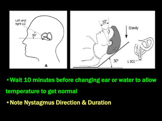 •Wait 10 minutes before changing ear or water to allow
temperature to get normal
•Note Nystagmus Direction & Duration
 