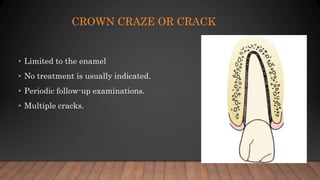 CROWN CRAZE OR CRACK
• Limited to the enamel
• No treatment is usually indicated.
• Periodic follow-up examinations.
• Multiple cracks.
 