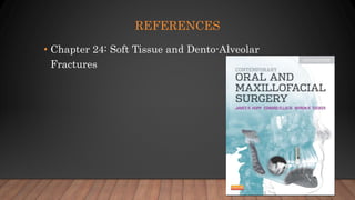 REFERENCES
• Chapter 24: Soft Tissue and Dento-Alveolar
Fractures
 
