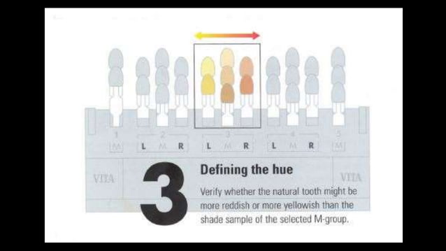 Teeth Normal Range Color Color of Natural Teeth and shade selection in dentistry. | PPT