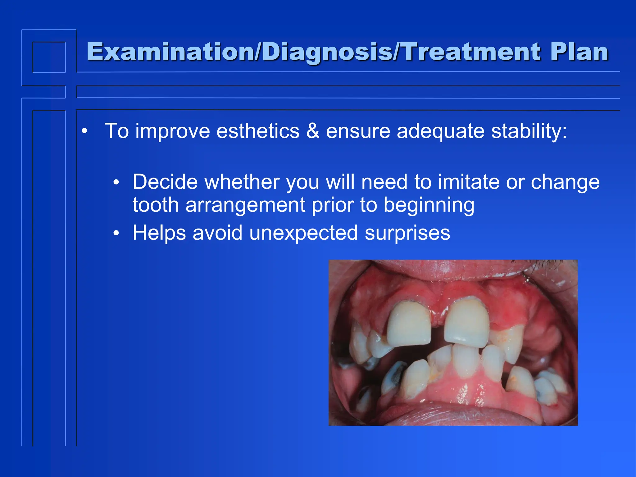 Examination/Diagnosis/Treatment Plan
• To improve esthetics & ensure adequate stability:
• Decide whether you will need to imitate or change
tooth arrangement prior to beginning
• Helps avoid unexpected surprises
 