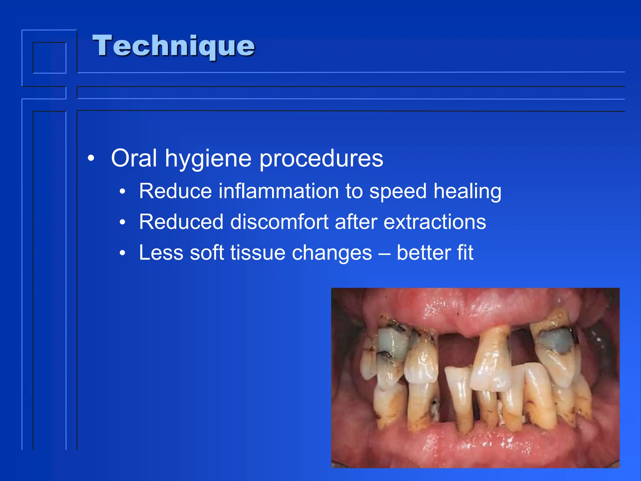 Technique
• Oral hygiene procedures
• Reduce inflammation to speed healing
• Reduced discomfort after extractions
• Less soft tissue changes – better fit
 