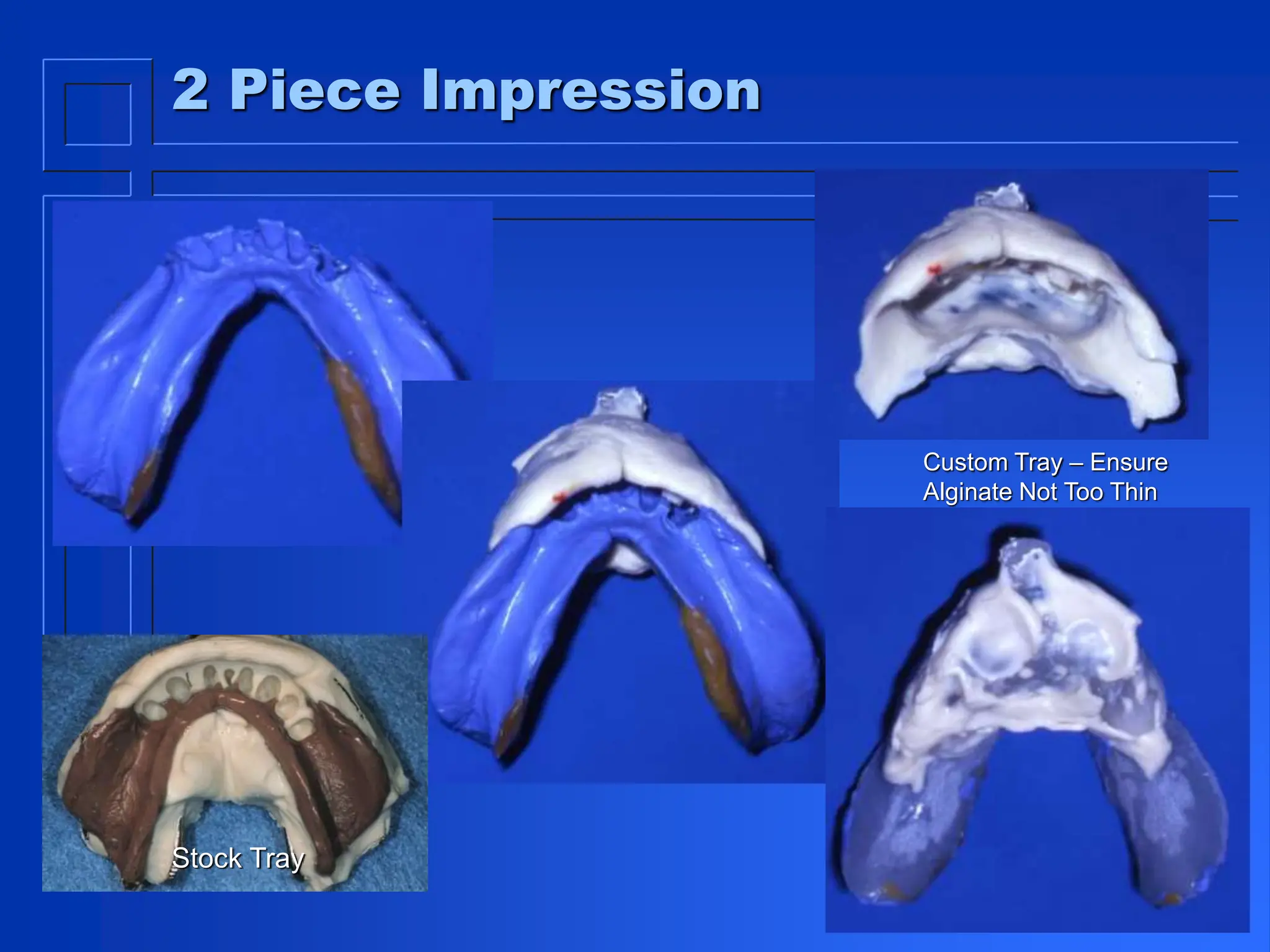 2 Piece Impression
Stock Tray
Custom Tray – Ensure
Alginate Not Too Thin
 