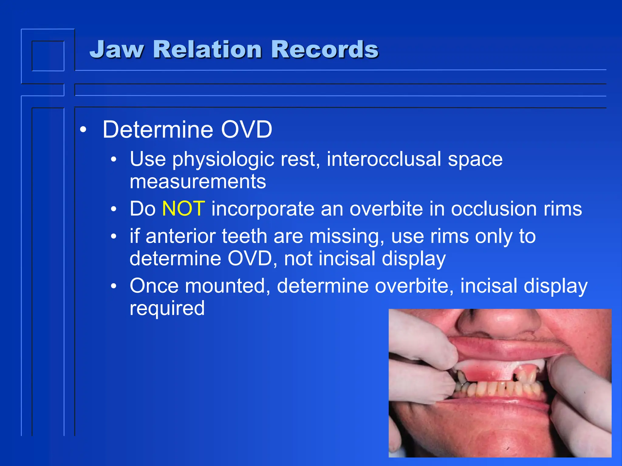 Jaw Relation Records
• Determine OVD
• Use physiologic rest, interocclusal space
measurements
• Do NOT incorporate an overbite in occlusion rims
• if anterior teeth are missing, use rims only to
determine OVD, not incisal display
• Once mounted, determine overbite, incisal display
required
 