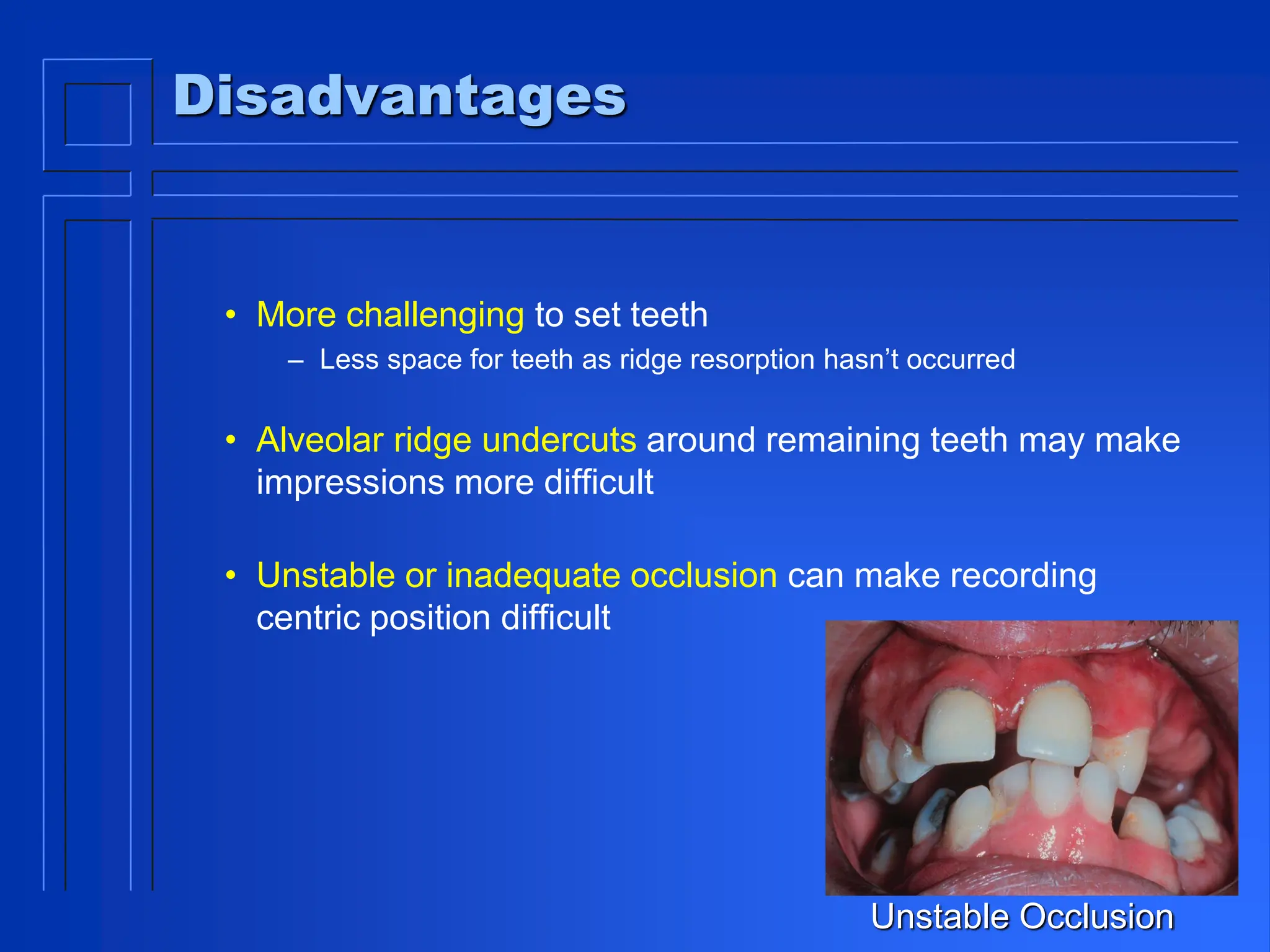 Disadvantages
• More challenging to set teeth
– Less space for teeth as ridge resorption hasn’t occurred
• Alveolar ridge undercuts around remaining teeth may make
impressions more difficult
• Unstable or inadequate occlusion can make recording
centric position difficult
Unstable Occlusion
 