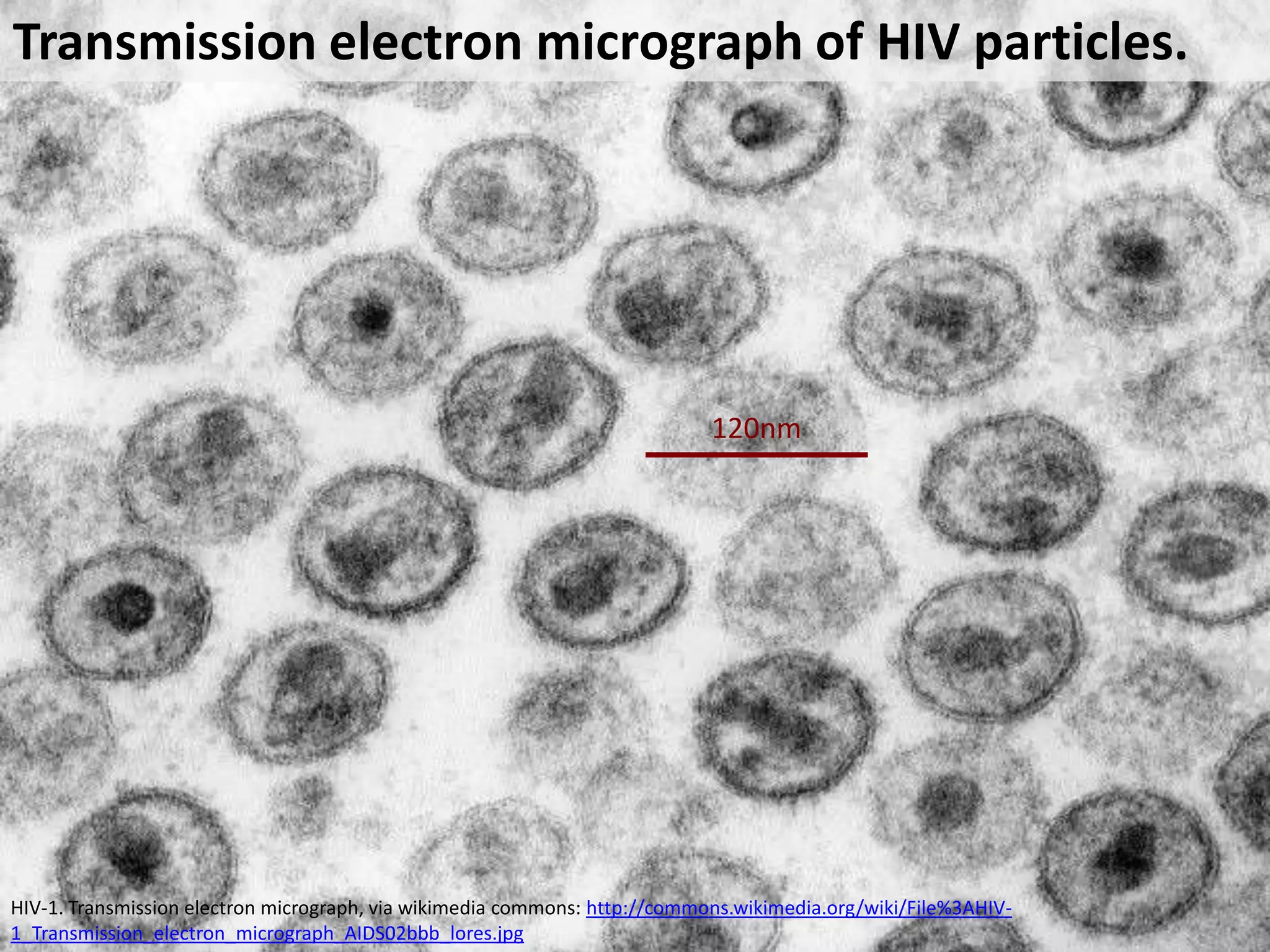 Transmission electron micrograph of HIV particles.

120nm

HIV-1. Transmission electron micrograph, via wikimedia commons: http://commons.wikimedia.org/wiki/File%3AHIV1_Transmission_electron_micrograph_AIDS02bbb_lores.jpg

 