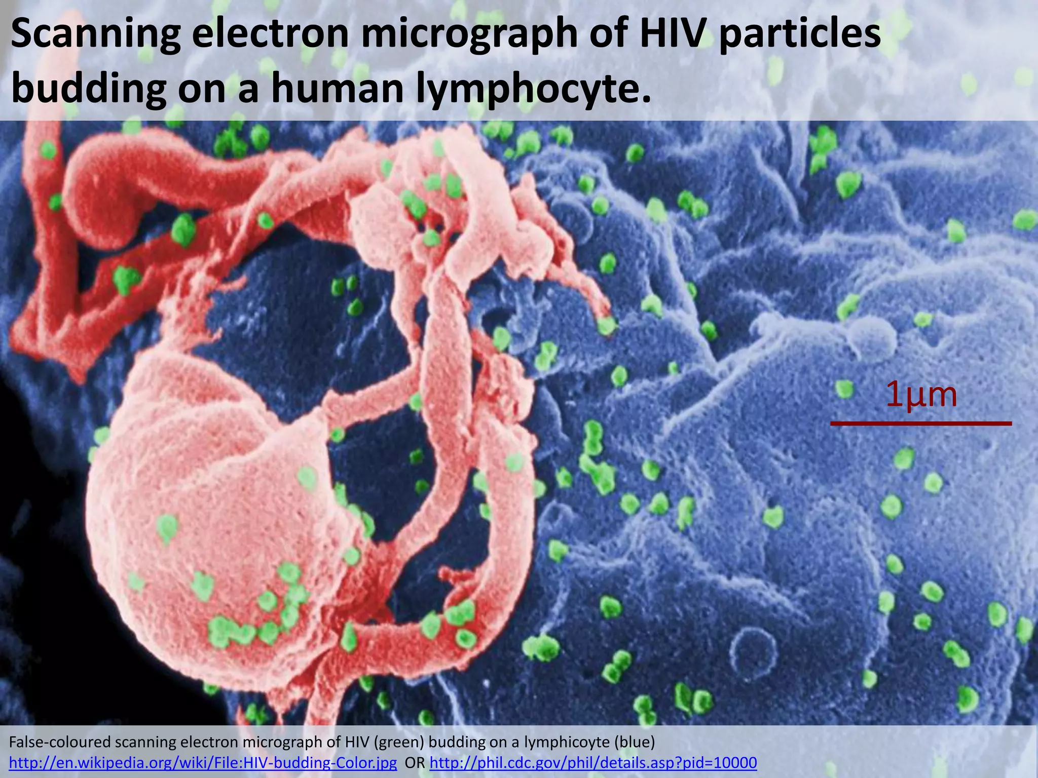 Scanning electron micrograph of HIV particles
budding on a human lymphocyte.

1μm

False-coloured scanning electron micrograph of HIV (green) budding on a lymphicoyte (blue)
http://en.wikipedia.org/wiki/File:HIV-budding-Color.jpg OR http://phil.cdc.gov/phil/details.asp?pid=10000

 