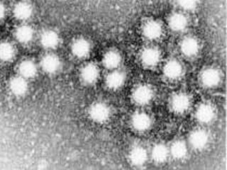 21-Hepatitis_Viruses.ppt