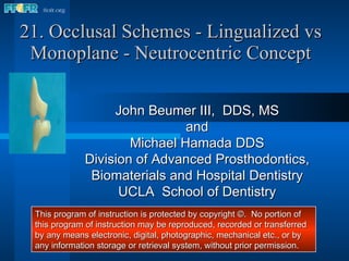 21. Occlusal Schemes - Lingualized vs Monoplane - Neutrocentric Concept John Beumer III,  DDS, MS and Michael Hamada DDS Division of Advanced Prosthodontics, Biomaterials and Hospital Dentistry UCLA  School of Dentistry This program of instruction is protected by copyright ©.  No portion of this program of instruction may be reproduced, recorded or transferred by any means electronic, digital, photographic, mechanical etc., or by any information storage or retrieval system, without prior permission. 