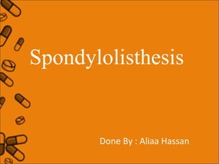Spondylolisthesis

Done By : Aliaa Hassan

 