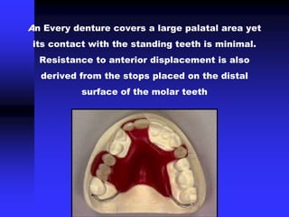 An Every denture covers a large palatal area yet
its contact with the standing teeth is minimal.
Resistance to anterior displacement is also
derived from the stops placed on the distal
surface of the molar teeth
 