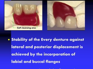  Stability of the Every denture against
lateral and posterior displacement is
achieved by the incorporation of
labial and buccal flanges
 