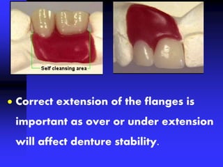  Correct extension of the flanges is
important as over or under extension
will affect denture stability.
 