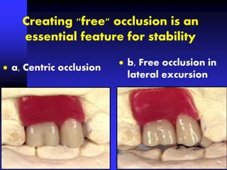 Creating "free" occlusion is an
essential feature for stability
 b, Free occlusion in
lateral excursion
 a, Centric occlusion
 