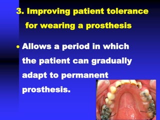 3. Improving patient tolerance
for wearing a prosthesis
 Allows a period in which
the patient can gradually
adapt to permanent
prosthesis.
 