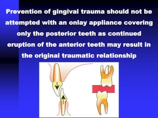 Prevention of gingival trauma should not be
attempted with an onlay appliance covering
only the posterior teeth as continued
eruption of the anterior teeth may result in
the original traumatic relationship
 