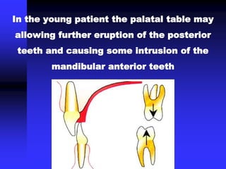 In the young patient the palatal table may
allowing further eruption of the posterior
teeth and causing some intrusion of the
mandibular anterior teeth
 