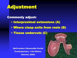 Adjustment
(McCracken's Removable Partial
Prosthodontics, 11th Edition.
Elsevier, 2005)
Commonly adjust:
• Interproximal extensions (A)
• Where clasp exits from resin (B)
• Tissue undercuts (C)
 
