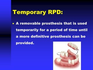 Temporary RPD:
 A removable prosthesis that is used
temporarily for a period of time until
a more definitive prosthesis can be
provided.
 