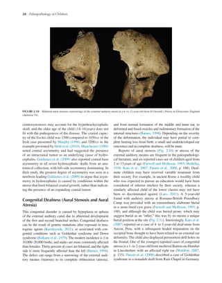 Paleopathology Examples Paleopathology Of Children First Mary Lewis | PDF