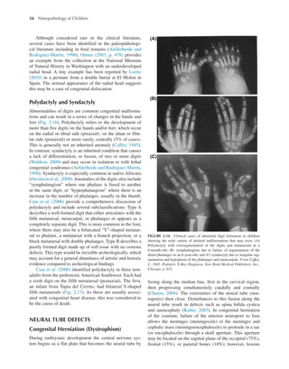 Paleopathology Examples Paleopathology Of Children First Mary Lewis | PDF