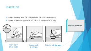 210126-Implant-Insertion-and-removal.pptx