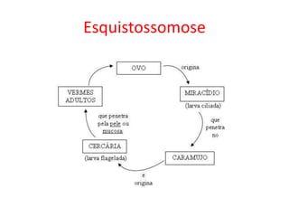 Esquistossomose
 