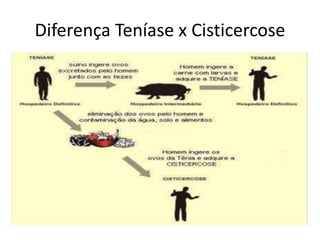 Diferença Teníase x Cisticercose
 