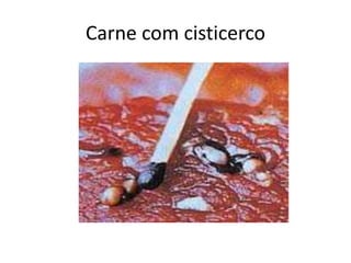 Carne com cisticerco
 