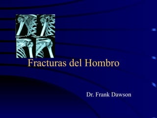 Fracturas del Hombro Dr. Frank Dawson 