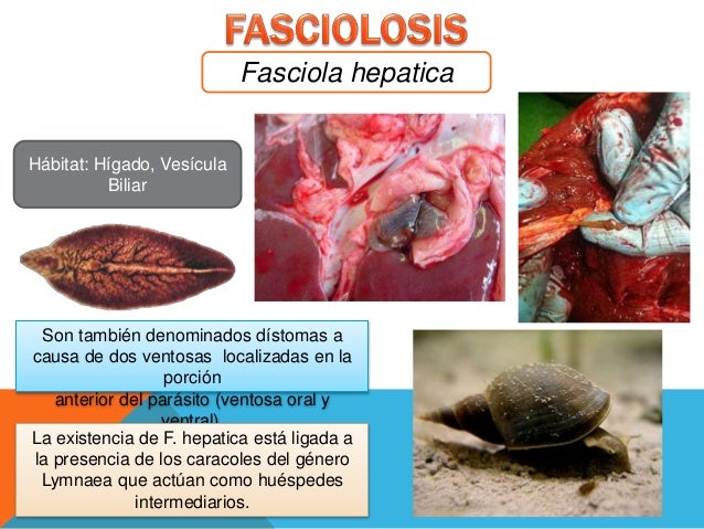 Fasciolosis Parasitología