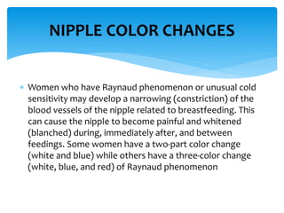  Women who have Raynaud phenomenon or unusual cold
sensitivity may develop a narrowing (constriction) of the
blood vessels of the nipple related to breastfeeding. This
can cause the nipple to become painful and whitened
(blanched) during, immediately after, and between
feedings. Some women have a two-part color change
(white and blue) while others have a three-color change
(white, blue, and red) of Raynaud phenomenon
NIPPLE COLOR CHANGES
 