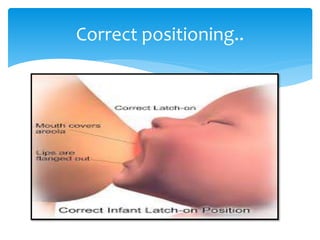 Correct positioning..
 