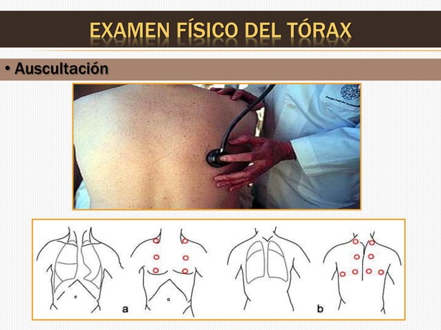 Examen Fisico De Torax Normal Ejemplo