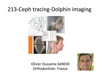 213-Ceph tracing-Dolphin imaging
Olivier Oussama SANDID
Orthodontiste- France
 