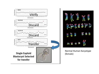 Normal Human Karyotype
(female)
 